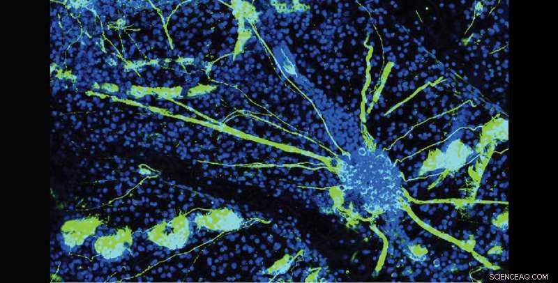 How Sea Squirts Illuminate Human Neurodegenerative Diseases