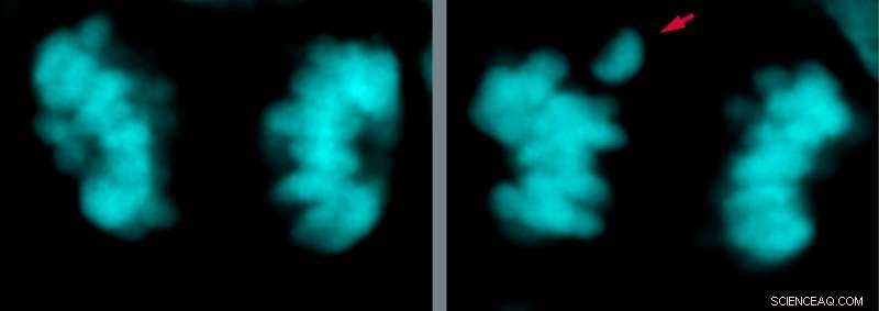 Neanderthal vs Modern Human Brain Development: Key Genetic Differences Revealed