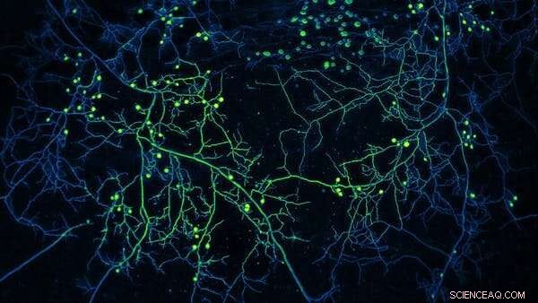 Australia’s Soil Crisis: Immediate Restoration Needed to Protect Ecosystems