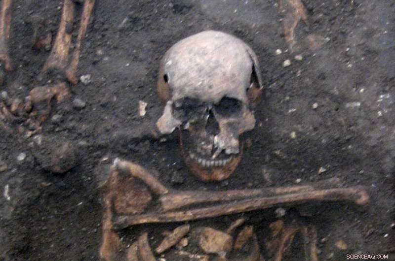 Tracing Cold Sore Virus Origins: Ancient Herpes DNA Reveals Prehistoric Roots