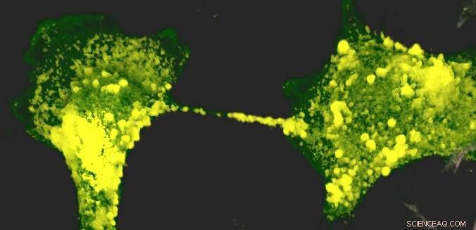 SARS-CoV-2 Uses Neuronal Nanotubes to Infect Brain Cells