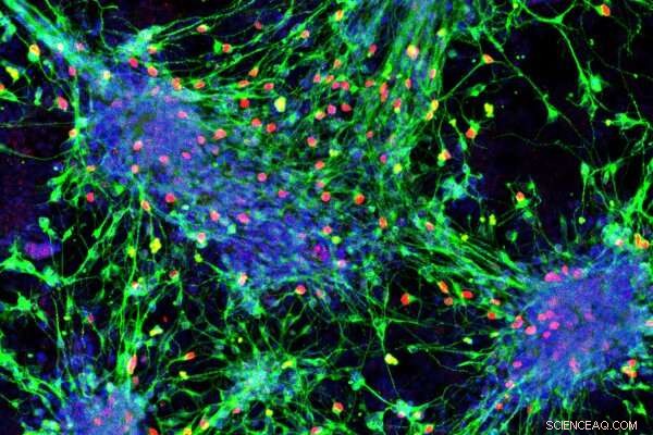 New Blueprint Converts Stem Cells into Sensory Interneurons