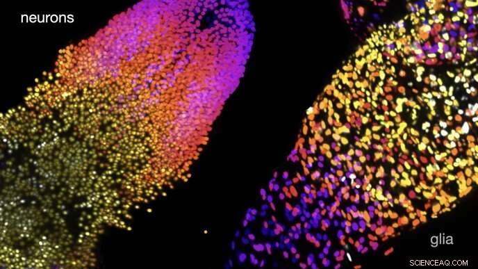 Advanced Computational Analysis Uncovers Significant Sex-Based Cell Count Differences in Fruit Fly Larvae Brains