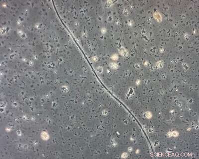 Cable Bacteria: Nature’s Electrifying Microbial Networks