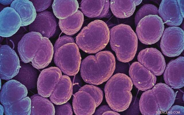 How Gonorrhea May Have Shaped Human Genes for Brain Health