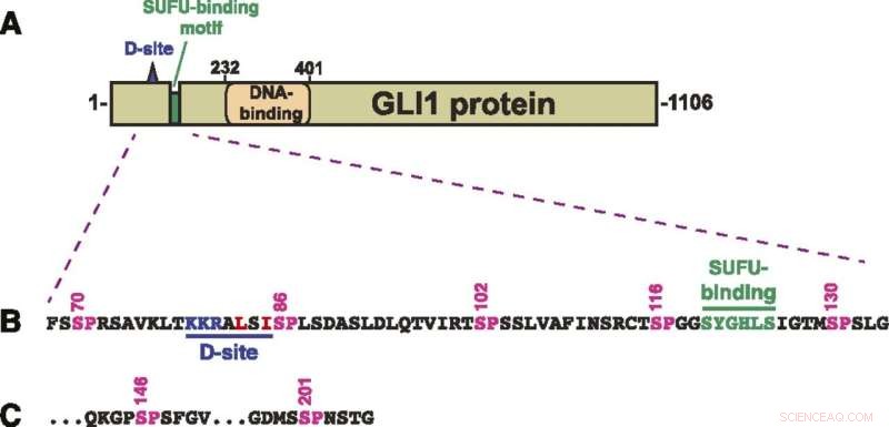 GLI1 Deregulation: How Protein Liberation Fuels Aggressive Cancers