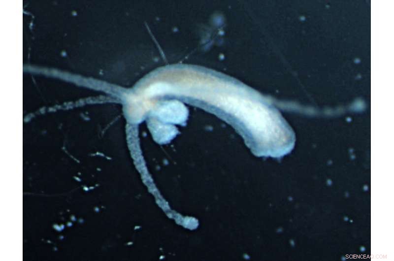 How Genetic Changes in the Hippo Pathway Influence Body Axis Formation in Hydra