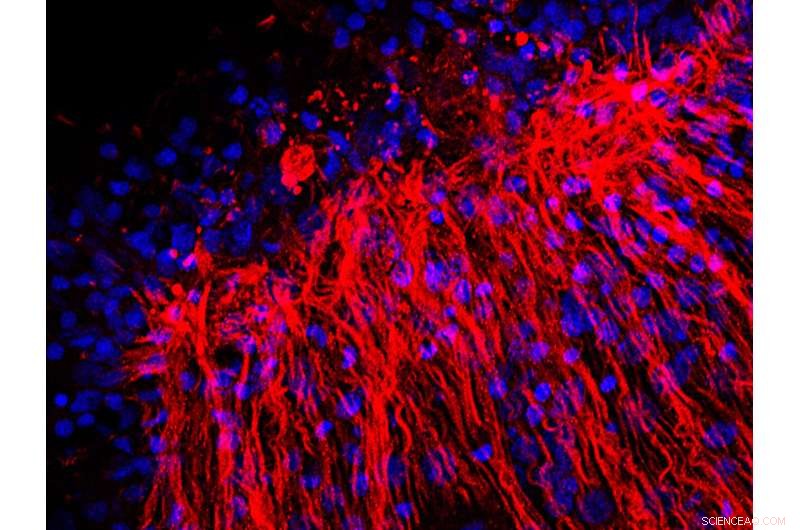 How Genetic Changes in the Hippo Pathway Influence Body Axis Formation in Hydra