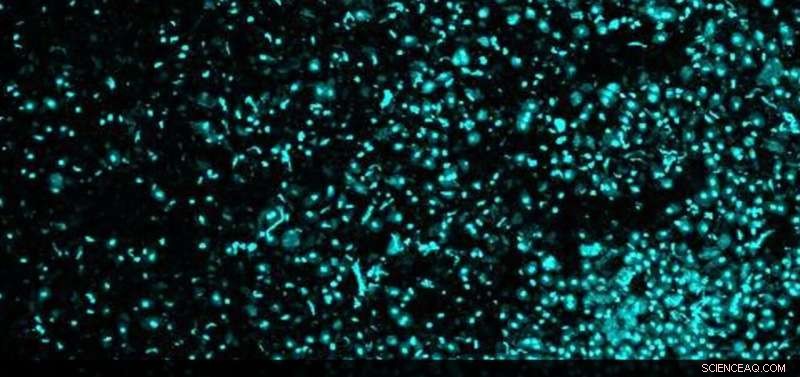 New Electric Field Technique Enables Precise Isolation of Individual Cancer Cells