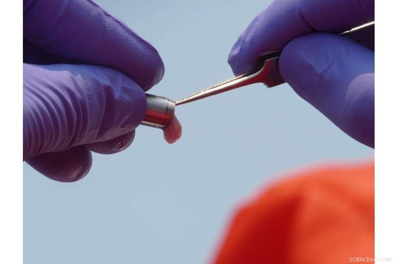 Persistent PBDE Contamination Threatens St. Lawrence River Ecosystem and Endangered Beluga Whales