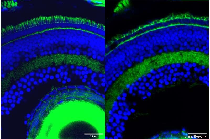 Tiny Gene Fragments Found to Play Key Roles in Retinal Development and Vision