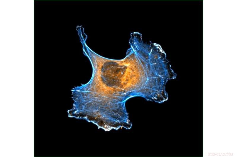 How Cancer Cells Navigate Tissue: Unraveling the Role of Rigidity in Cell Migration