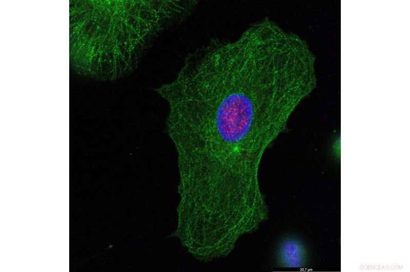 New Mechanism Reveals How the Innate Immune System Detects HIV Early