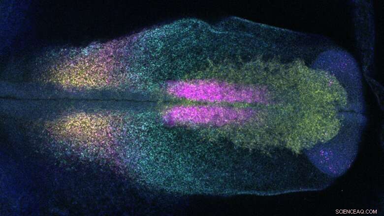 King s Study Reveals Sox8 Gene Drives Ear Formation in Early Embryonic Development