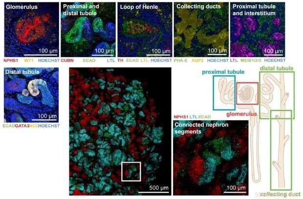 Advancing Kidney Regeneration: Biomaterials for Organoid‑Based Therapies