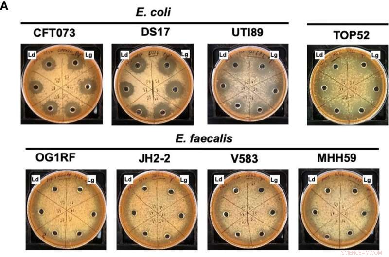 Female Urinary Tract Lactobacilli Effectively Suppress Pathogenic Bacteria
