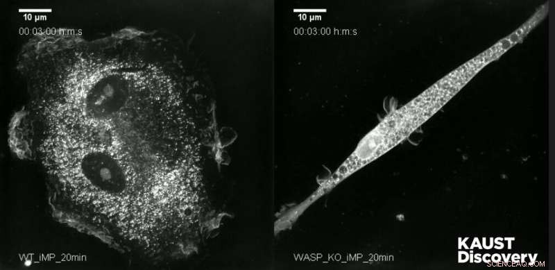 Stem Cell Research Illuminates Mechanisms of Wiskott-Aldrich Syndrome
