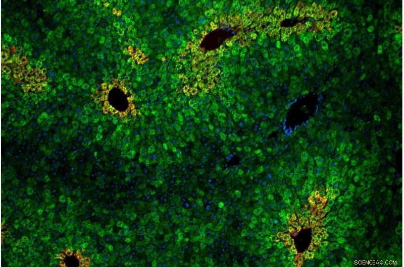 How the Body Detects the Essential Amino Acid Leucine: Insights from Whitehead Institute Research