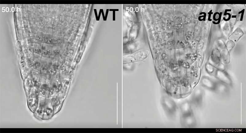 New Insights into Autophagy’s Role in Plant Cell Differentiation and Root Cap Detachment