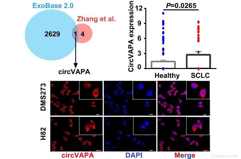 Circular RNA Drives Small Cell Lung Cancer Progression: New Mechanistic Insights