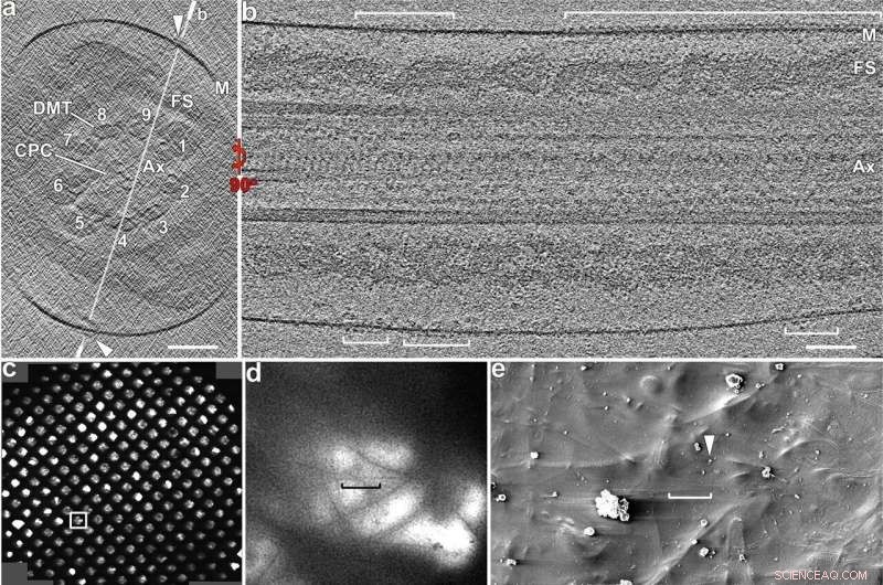 Unveiling the Tail’s Architecture: How It Drives Sperm Forward