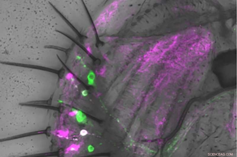 Fruit Flies Detect and Avoid Excess Salt: New Insights into Sensory Mechanisms