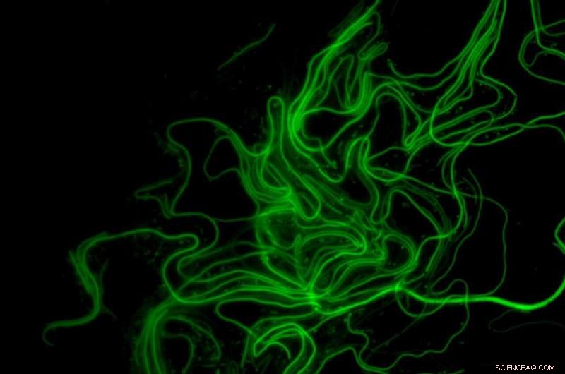 Bacterial Shape-Shifting Behavior Offers Clues to Novel UTI Therapies