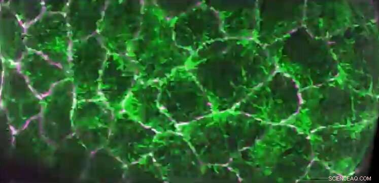 The Dynamic Cell Skeleton: Live Imaging Reveals Cellular Construction