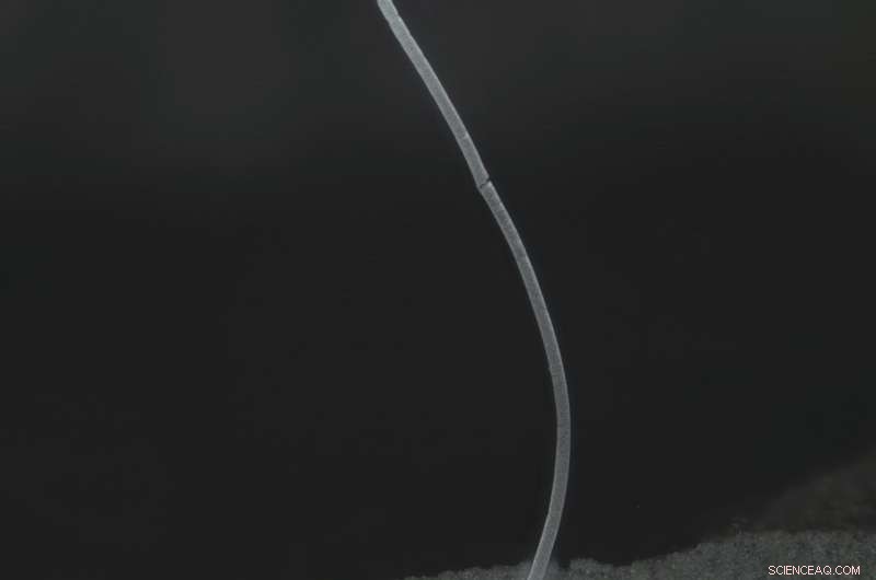 World s Largest Bacterium Uncovered in Caribbean Mangrove Swamp