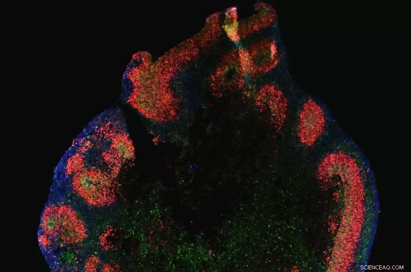 Advanced Cortical Organoids: Mini Brains That Replicate Human Brain Development and Disease