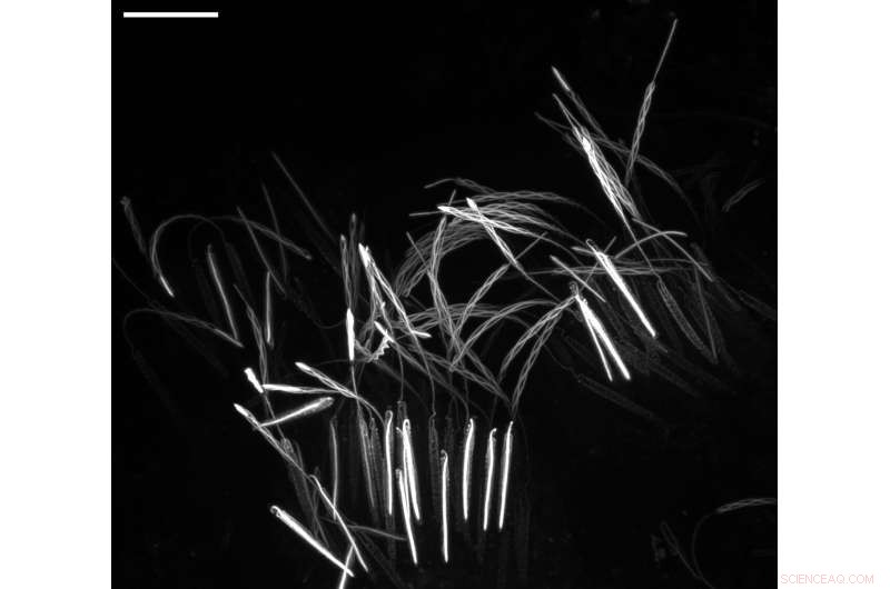 Inside the Jellyfish Sting: Unveiling the Micro-Architecture of a Cellular Weapon