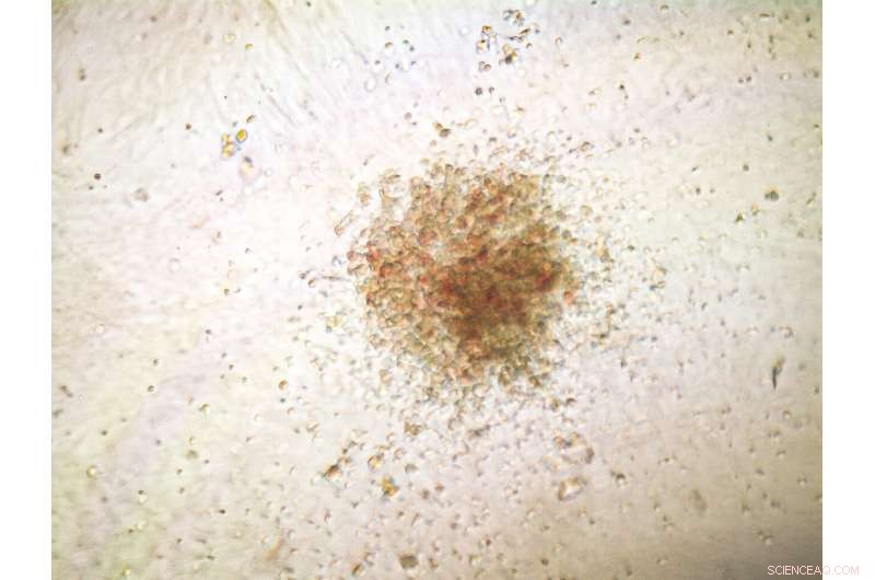 Precise Gene Editing Technique Reduces Off‑Target Effects in Blood Stem Cells