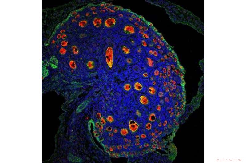 WT1 Gene Deletion Disrupts Male and Female Reproductive Organ Development in Mice