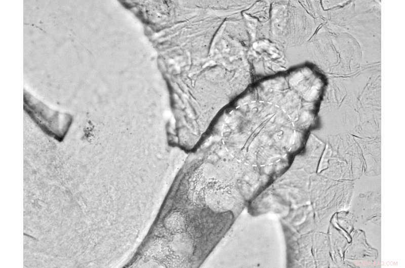 Inside the Skin: How Demodex Mites Influence Facial Health