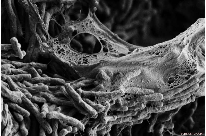 Genetic Mutations Accelerate Rapid Evolution of Mycobacterium tuberculosis