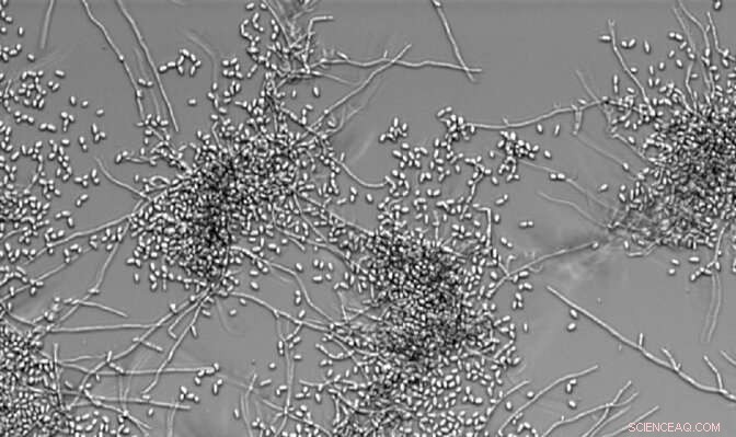 How Lactic Acid Bacteria Help Intestinal Cells Fight Candida Infections