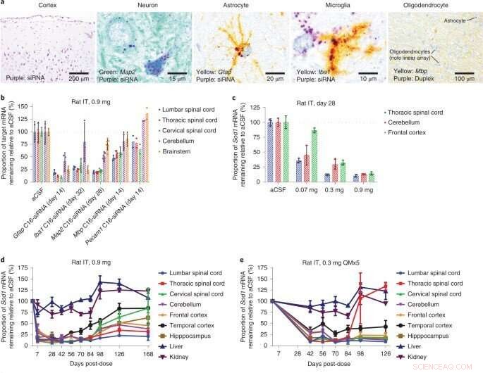 Optimizing siRNA Design for CNS Delivery: From Lab Innovation to Clinical Application