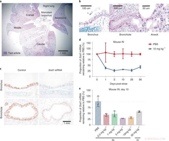 Optimizing siRNA Design for CNS Delivery: From Lab Innovation to Clinical Application
