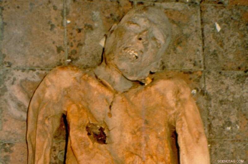 Ancient E. coli Genome Reconstructed from 16th‑Century Italian Mummy Gallstones