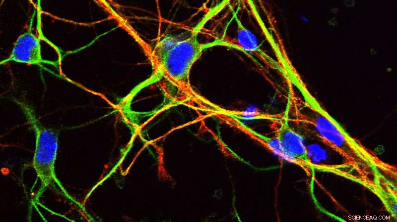 Scientists Decode How Non‑Protein‑Coding Genes Drive Brain Development