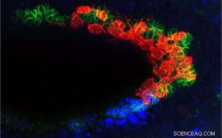 CVM Cells: BMP Signals That Trigger Self‑Destruction During Embryonic Development