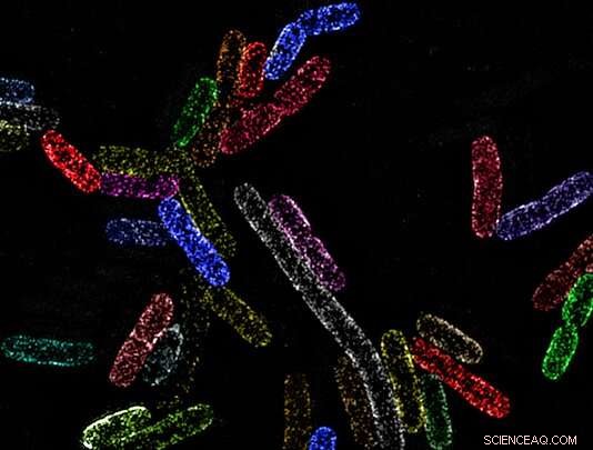 New Study Reveals Vulnerability in Gram‑Negative Bacterial Outer Membrane
