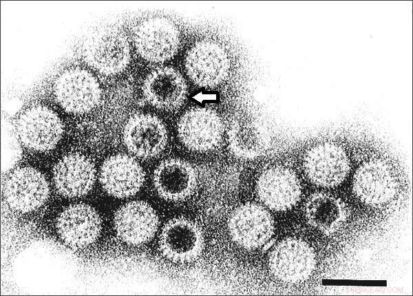 AI Reveals Novel 3D Structure of Rotavirus Spike Protein