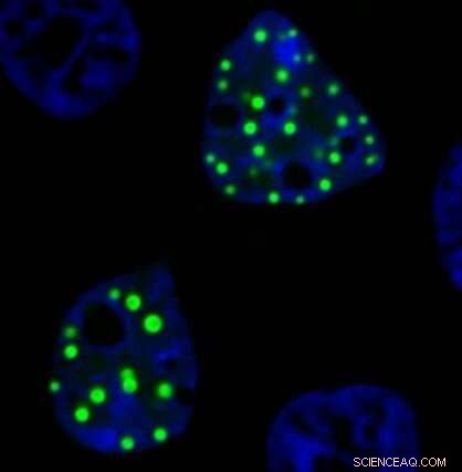 Chimeric, Droplet-Forming Proteins: Their Role in Cancer Development