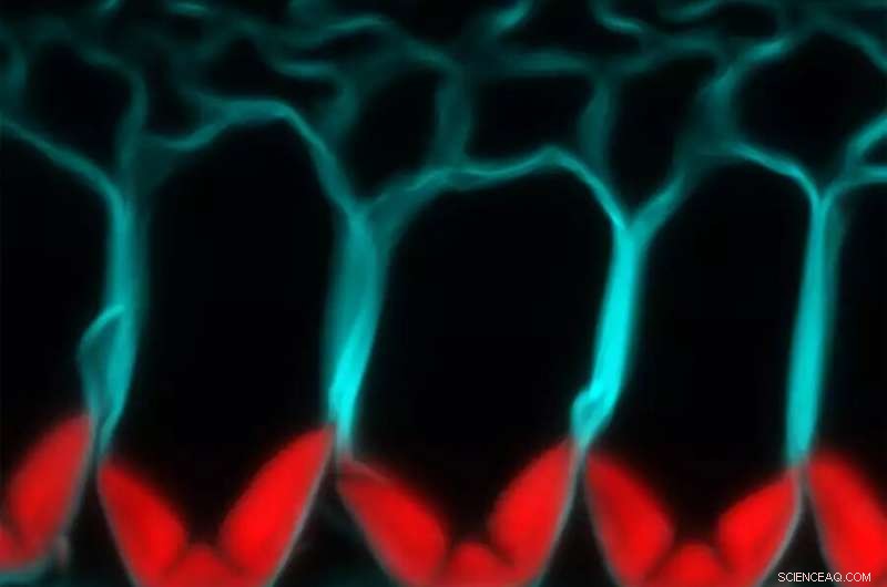 CRISPR Uncovers Laccase Enzymes Behind Lignin-Mediated Seed Pod Explosion