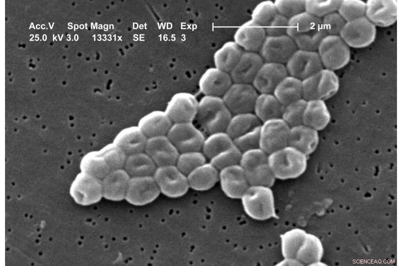 From Environmental Microbe to Hospital Hazard: The Rise of Acinetobacter baumannii