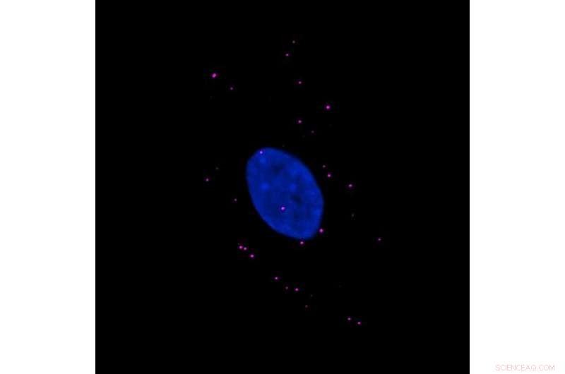 NEMO Protein Phase Separation Drives Immune Response in Human Cells