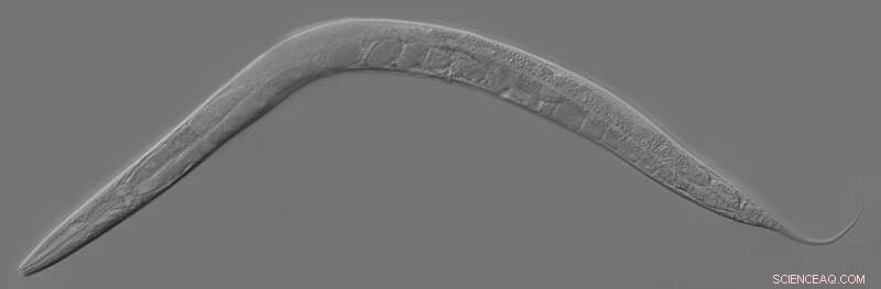 Roundworms Reveal Novel Mechanisms in Bardet-Biedl Syndrome Research