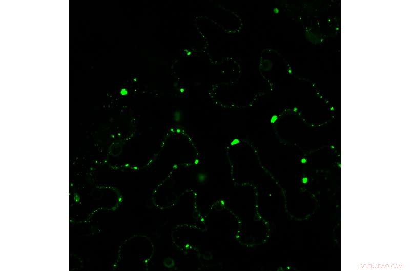 Plant Defense Mechanisms: How Pathogens Inhibit Autophagy