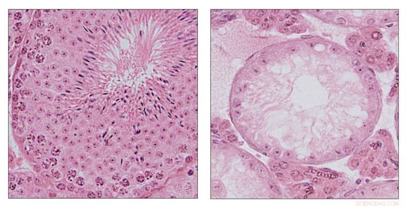 Testicular Warming & Spermatogenesis Failure: Understanding Male Infertility
